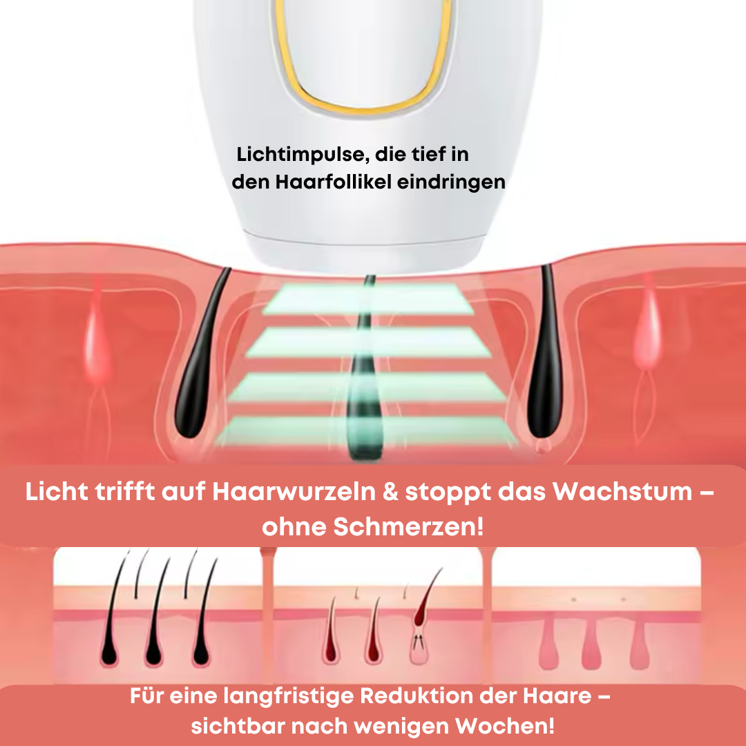 AARYA LUMISKIN – Deine Revolution für sanfte Haarentfernung